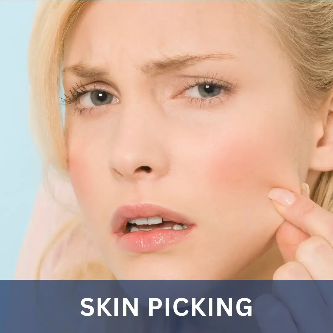 Skin Picking - Breaking Habits Burlington Hypnosis